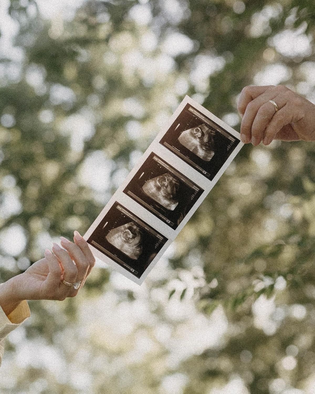 Baby ultrasound